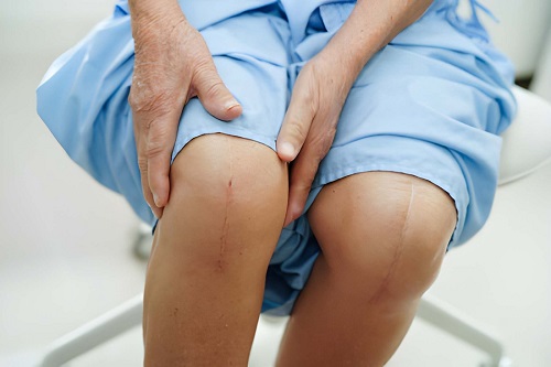Best Knee Replacement Surgeon in Kurla, Mumbai